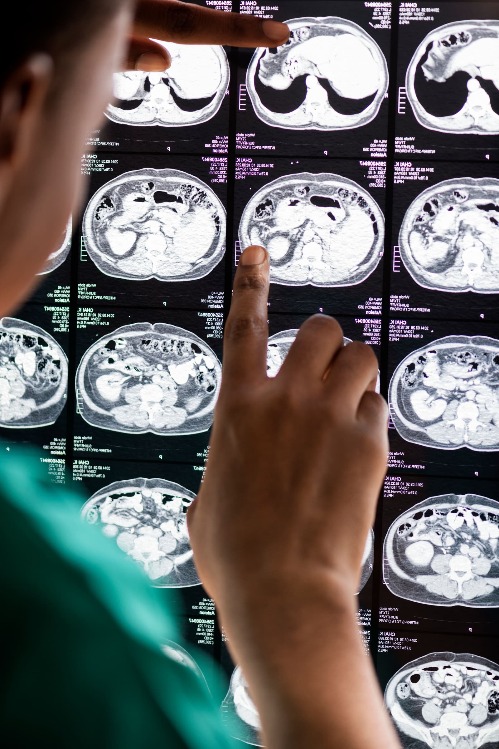 Paciente em equipamento de ressonância magnética com técnica analisando exame ao fundo